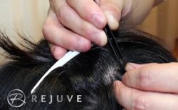 ナチュラル（株）増毛の様子